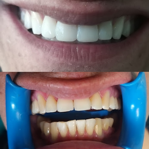 Consultorio Odontológico XIBRA - Dentista