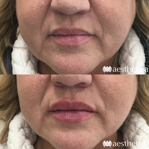 Explore danny phantom tattoo ideas, creative tattoo ideas in Pleasant Grove, available at Aesthetica