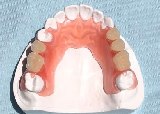 Opinii despre Dent Worry Protetyka Dentystyczna Katarzyna Albert-Szcześniak în Kalisz - Stomatolog