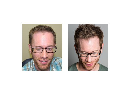 Hair Transplantation Clinic «Bosley Medical - Denver», reviews and photos, 6979 S Holly Cir #275, Centennial, CO 80112, USA