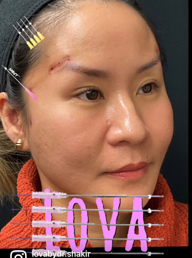 Explore gypsy tattoo ideas, creative tattoo ideas in Lake Oswego, available at Lake Oswego Vein and Aesthetic LOVA