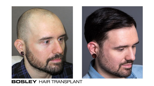 Hair Transplantation Clinic «Bosley Medical - Long Island», reviews and photos, 324 S Service Rd Suite 122, Melville, NY 11747, USA