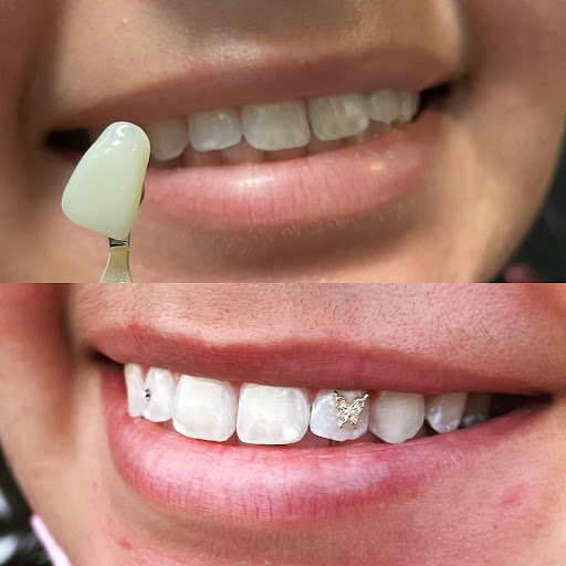 Explore skull forearm tattoo ideas, creative tattoo ideas in Kissimmee, available at Ol Skool Tattoos Studio