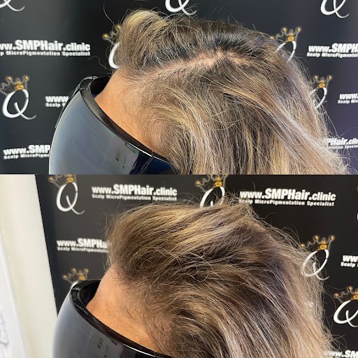 SMP Hair Clinic The Queen Of Scalp image