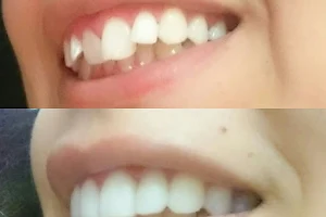 عيادات عمان سمايلز لطب الاسنان Amman Smiles Dental Clinics image