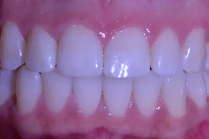 Braces N Faces image