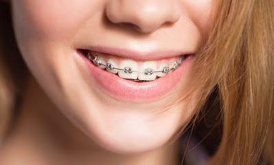 Dr David Atlan - Orthodontiste à Franconville