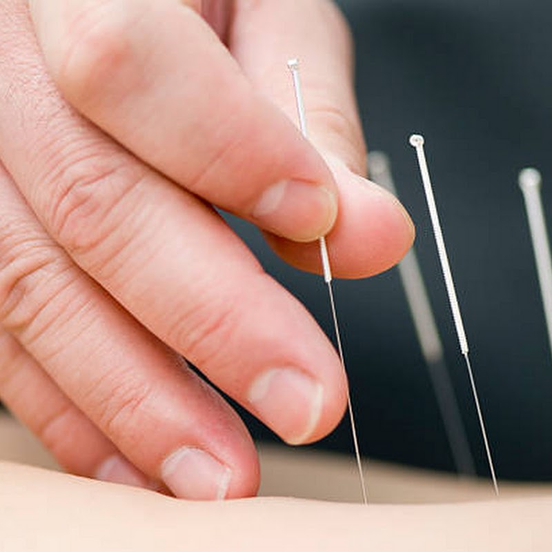 Complete Balance Chiropractic & Acupuncture