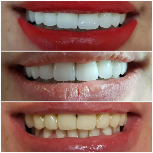 Opinii despre Cabinet stomatologic Dr.Mihaela Marc SC DENTAL M&C SRL în <nil> - Dentist
