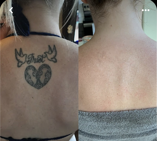 Explore arm tattoo ideas small, creative tattoo ideas in Las Vegas, available at Black Inc Laser Tattoo & Hair Removal