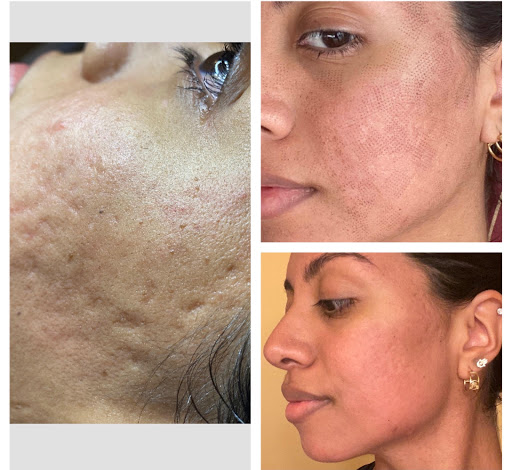 Laser Hair Removal Service «Dermalaser Med Spa», reviews and photos, 10560 NW 27th St #102, Doral, FL 33172, USA