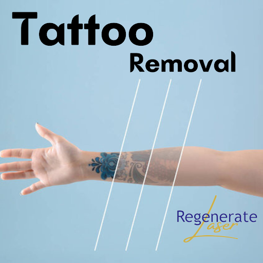 Explore branding tattoo ideas, creative tattoo ideas in Mcallen, available at Regenerate Laser
