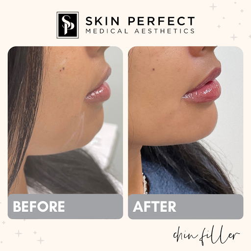 Find mama tattoo ideas for your next unique tattoo in Whittier at Skin Perfect Medical Aesthetics