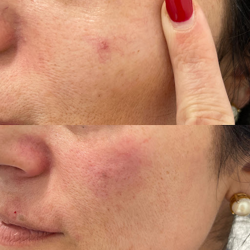 Explore queen tattoo ideas, creative tattoo ideas in Owensboro, available at The Skin Lab