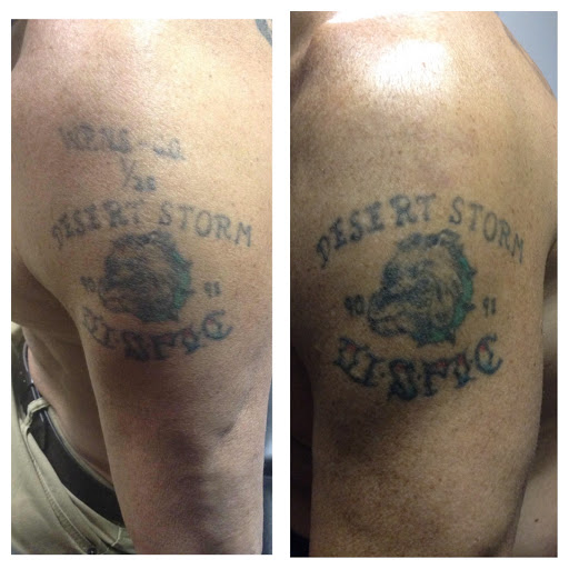 Explore linear tattoo ideas, creative tattoo ideas in Lawrence, available at Removery Tattoo Removal & Fading