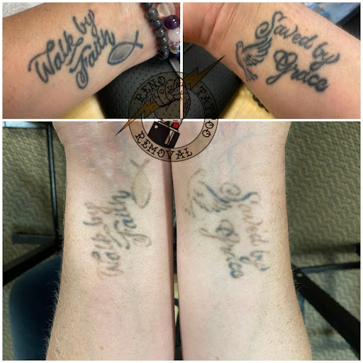 Explore turbo tattoo ideas, creative tattoo ideas in Reno, available at Reno Tattoo Removal