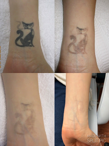 Explore disney princess tattoo ideas, creative tattoo ideas in Houston, available at Houston Tattoo Removal Clinic