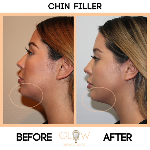Glow Aesthetic Center Encino image