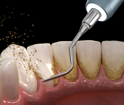 Sunny Family Dental image