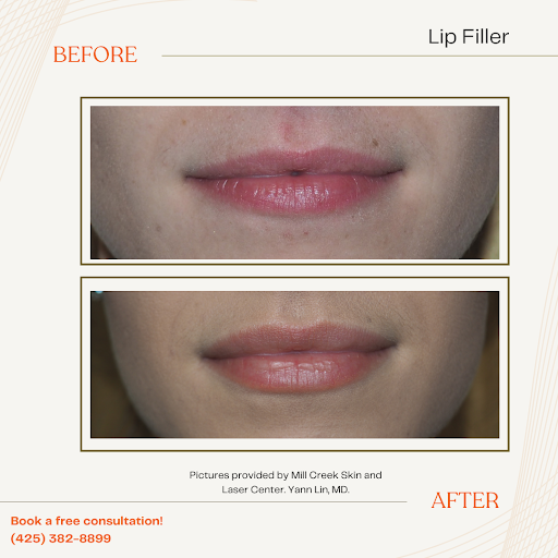 Explore gap filler tattoo filler ideas men, creative tattoo ideas in Bothell, available at Mill Creek Skin & Laser Center - Medspa
