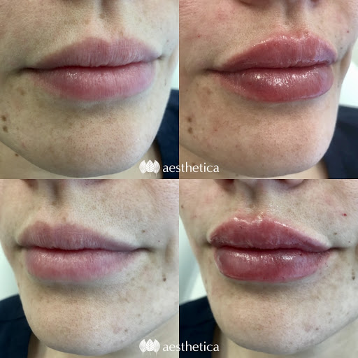 Explore biking tattoo ideas, creative tattoo ideas in Pleasant Grove, available at Aesthetica