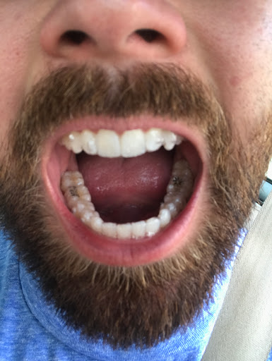 Smiles Cafe Dentistry image
