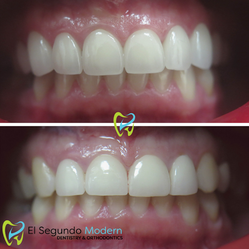 El Segundo Modern Dentistry image