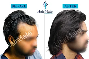 Hairmate Clinic Kolkata image