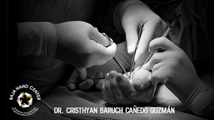 Dr. Baruch Cañedo Ortopedista Cirujano De Mano