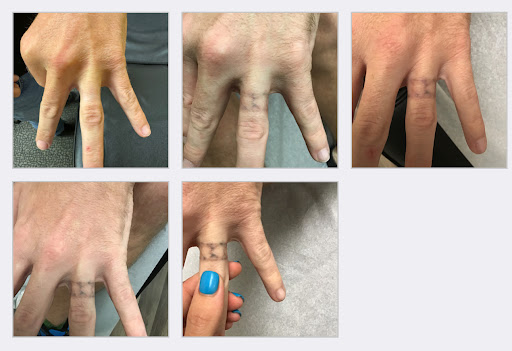 Explore tattoo sleeves ideas, creative tattoo ideas in Fort Myers, available at Laser Tattoo Removal by Tatt Cemetery