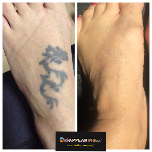 Explore tattoo ideas with names & designs, creative tattoo ideas in Northampton, available at Removery Tattoo Removal & Fading