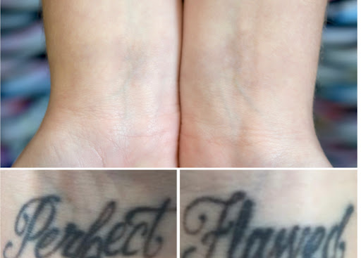 Explore tattoo ideas for aunt and niece, creative tattoo ideas in Rowlett, available at Bonsai Laser Tattoo Removal