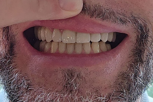 Redmond Dental Clinic