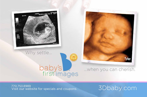 Baby's First Images Ultrasound