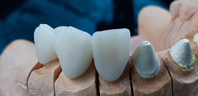 Opiniones de Técnico Protesista Dental Perkyns Málaga - Laboratorio Dental Cusco en Cusco - Dentista