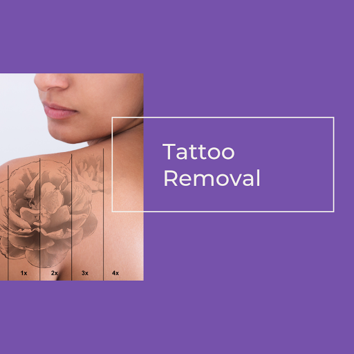 Explore 2 percent tattoo ideas, creative tattoo ideas in Tampa, available at Luminous Skin and Laser