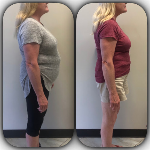 OC Weight Loss Centers & CoolSculpting image