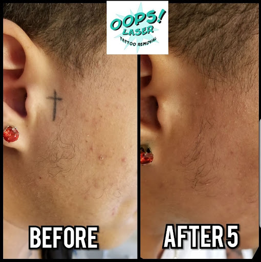 Explore haitian tattoo ideas, creative tattoo ideas in Tucson, available at Oops Laser