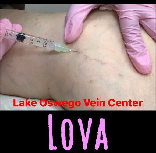 Find western cowboy tattoo ideas for your next unique tattoo in Lake Oswego at Lake Oswego Vein and Aesthetic LOVA