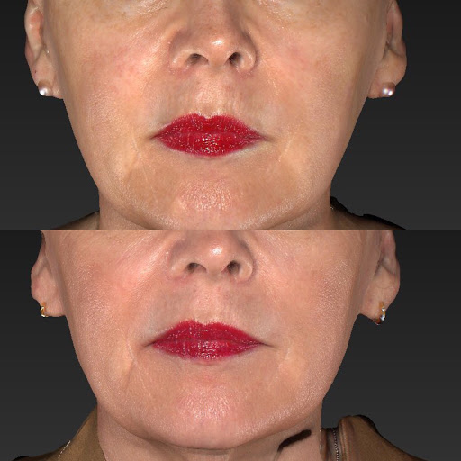 Explore tattoo cover up ideas for women, creative tattoo ideas in Summit, available at Ethos Aesthetics and Wellness, Laser Hair Removal and Med Spa