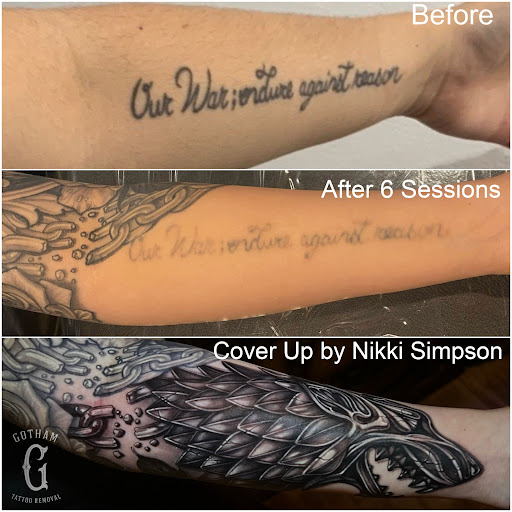 Explore tattoo ideas for dad and daughter, creative tattoo ideas in Brooklyn, available at Gotham Tattoo Removal