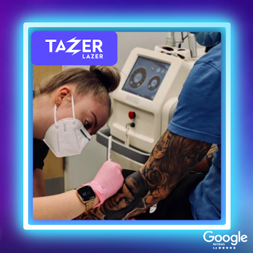 Comments and reviews of Tazer Lazer