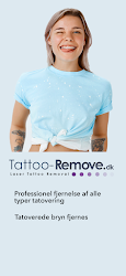 Tattoo-Remove.dk