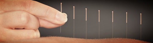 Auckland City Acupuncture & Beauty