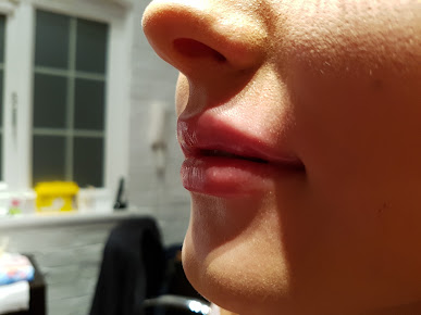 مركز إريان للجراحة التجميلية - ليستر - The Erian Centre for Cosmetic Surgery - Leicester