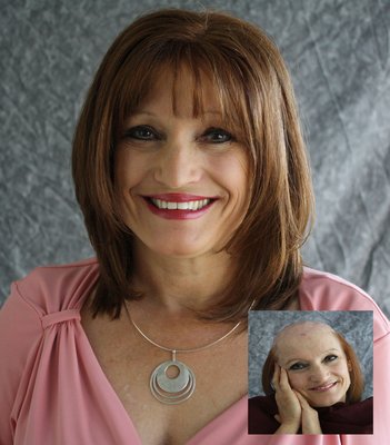 Hair Replacement Service «Elite Solutions Hair Loss Specialists of Sacramento», reviews and photos, 9294 Madison Ave, Orangevale, CA 95662, USA