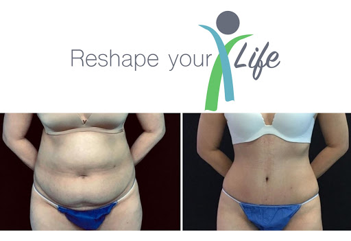 Cosmetic Surgery & Aesthetic Dentistry İn Turkey