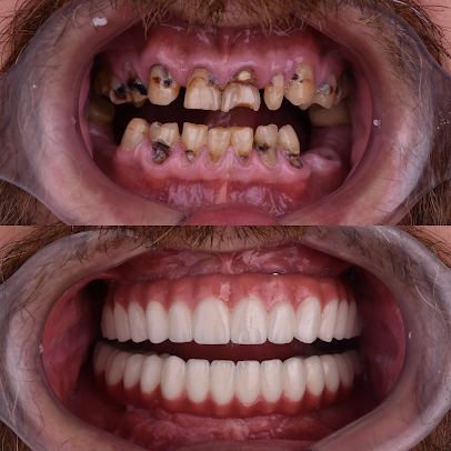 Cvejanovic - Cvejanovic