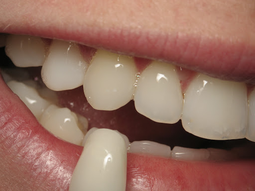 Ceramdent Dental Laboratories