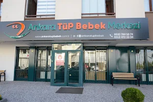 Ozel Ankara Tup Bebek Merkezi image